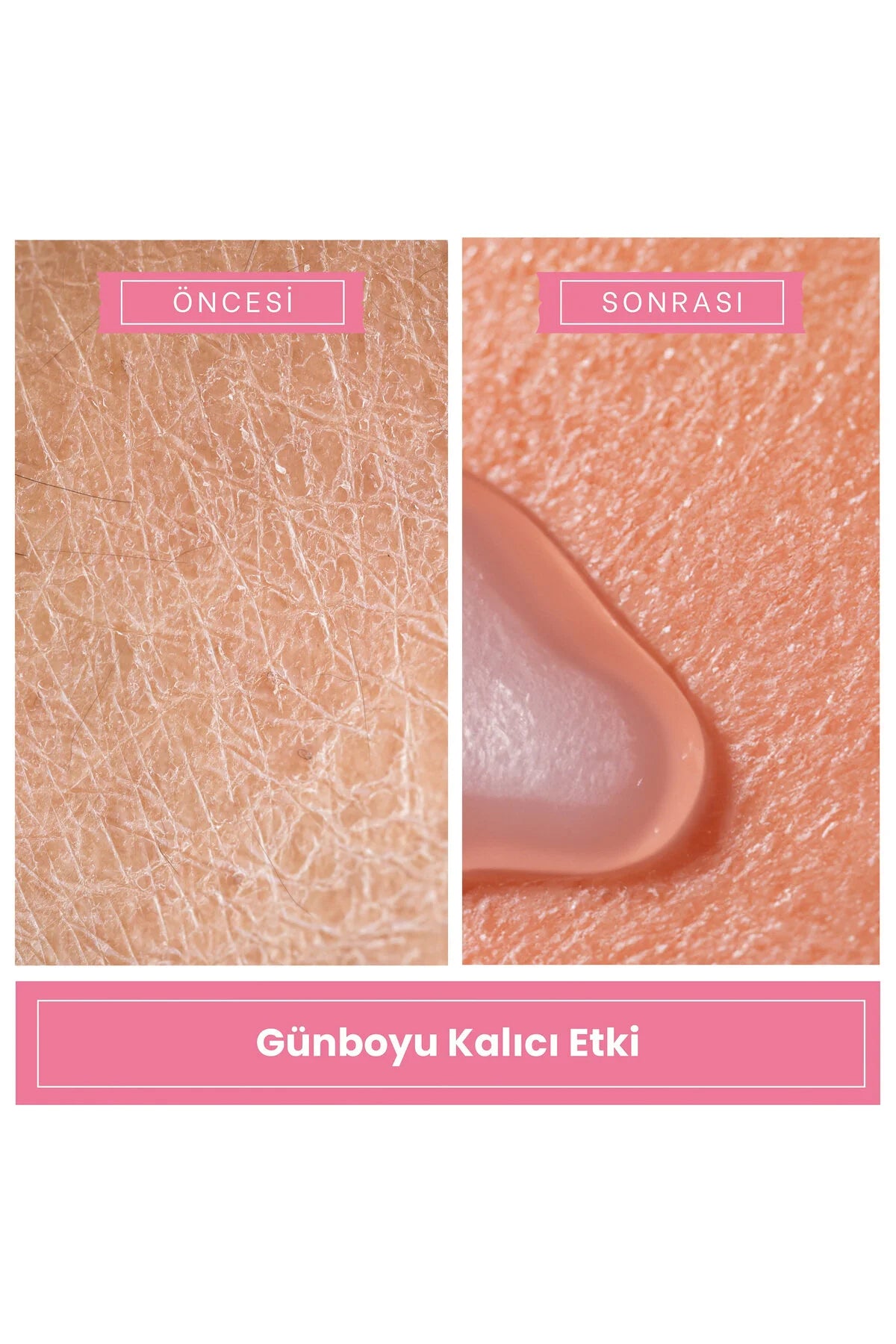 Aloe Vera Özlü Paraben Içermeyen Nemlendirici Krem